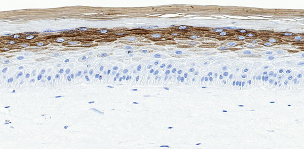 T-Skin 细胞角蛋白 10