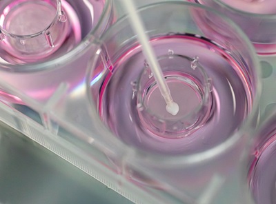 Skin and eye irritation China